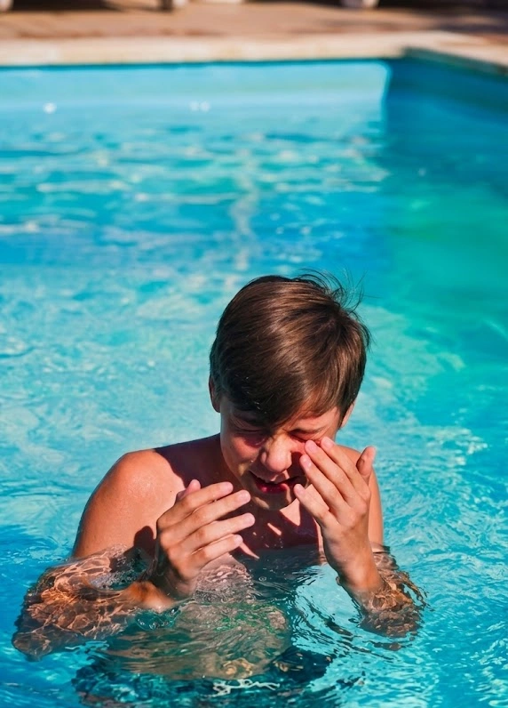 Irritación por exceso de cloro que un técnico de piscina debe balancear